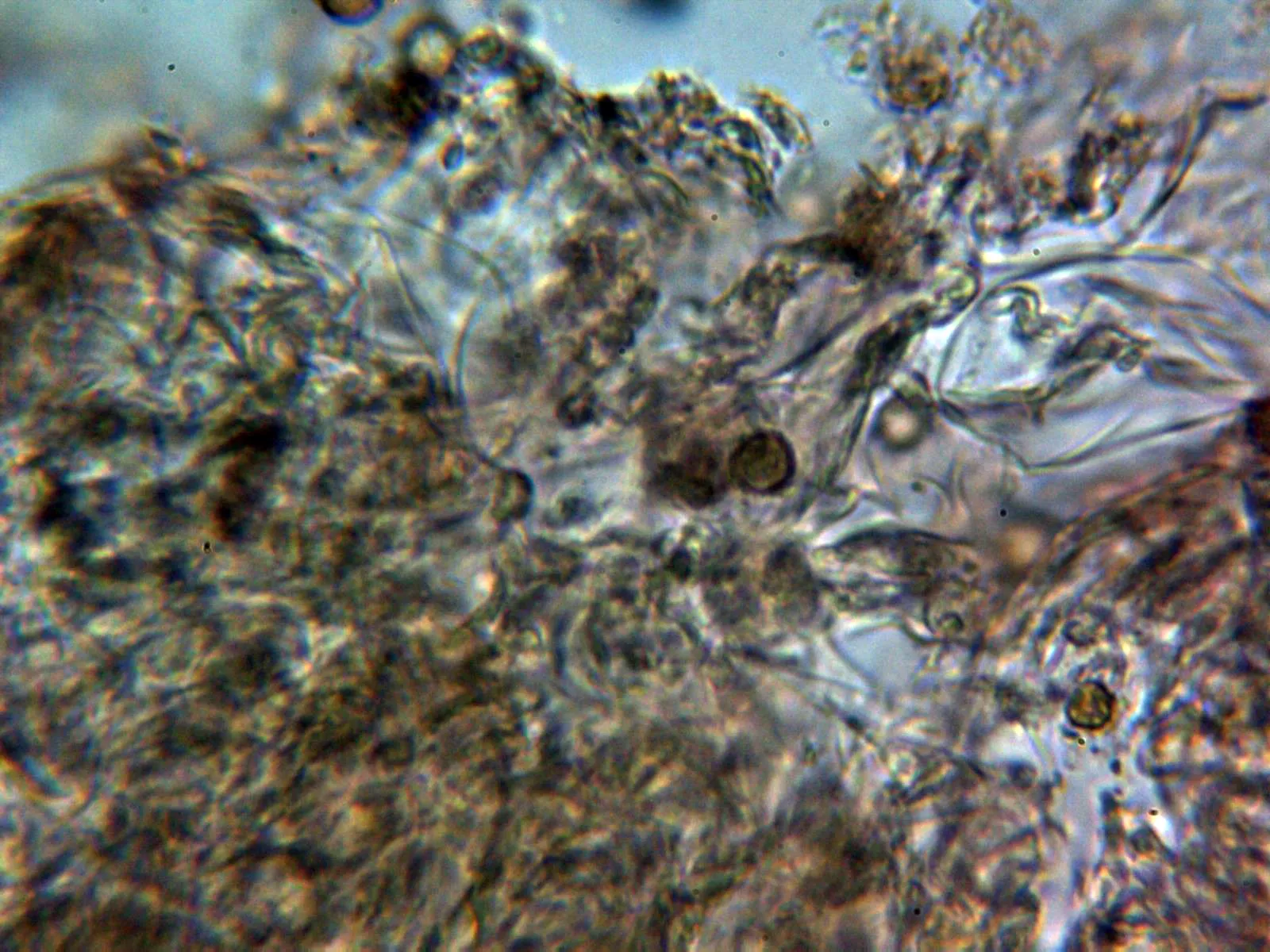 10 - Exoperidio parte interna 3